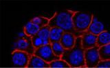 ImmunoPET技术有助于肿瘤的诊断和治疗