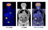 未来在免疫PET显像领域可能会获得突破性的进展