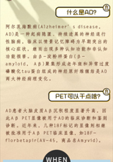 <p>淀粉样蛋白PET脑显像的操作技术</p>
