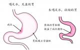 做PET/CT检查时，医生为什么让我“多喝水”？